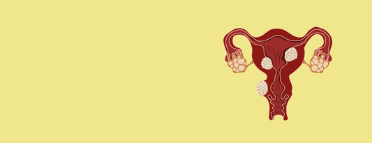 Shrinking Fibroids: Month 1